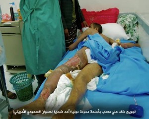 صابات بمركز الحروق بصنعاء تعرضت لقصف من أسلحة محرمة دولياً3
