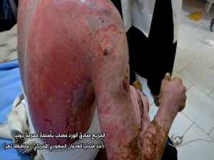 دليل على أسلحة محرمة10