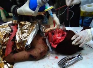 مجزرة نشور صعدة1