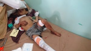 13931642_844413125689540_1254605181_o