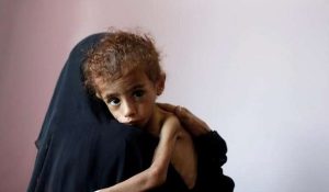 مسؤول أممي : اليمن على شفا كارثة والبشرية يجب أن تخجل من نفسها!