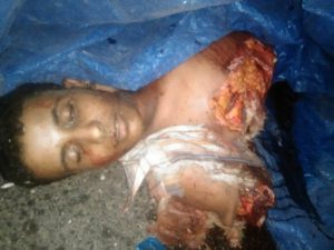 مجزرة في تعز طيران العدوان يرتكب1